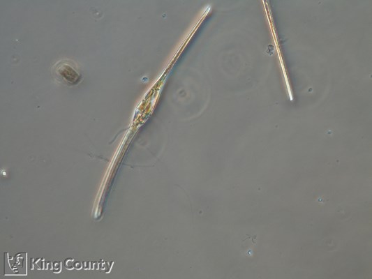 Photo of Ceratium fusus